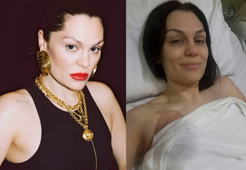 "Позволяю себе злиться". Джесси Джей, у которой обнаружили рак груди, рассказала о проведённой мастэктомии