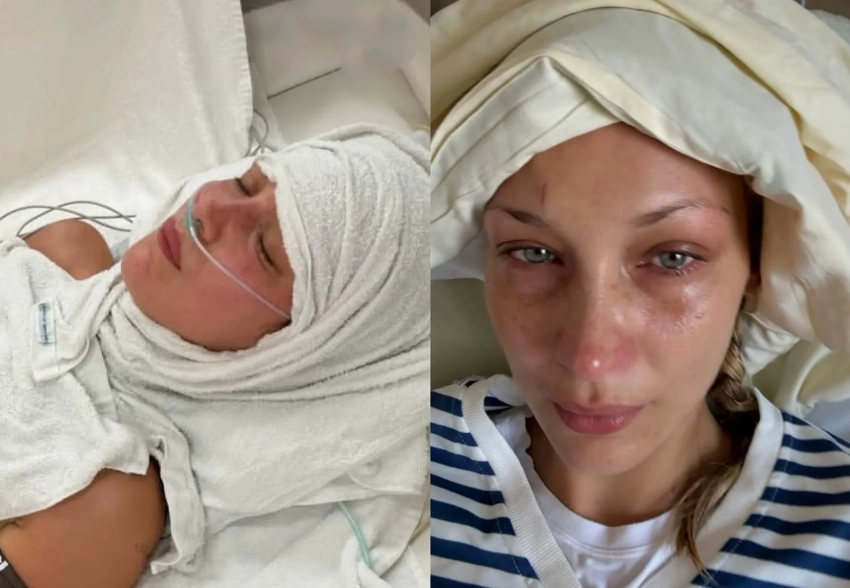 В сети подозревают, что Белла Хадид страдает не от болезни Лайма, а от последствий анорексии
